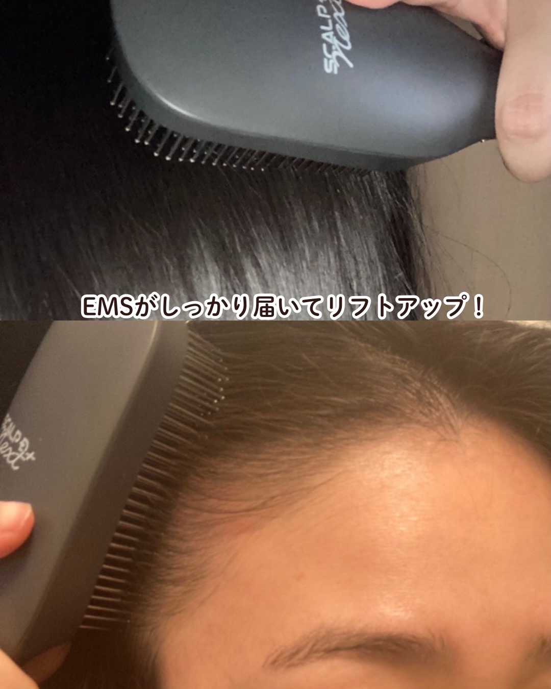 スカルプD ネクストプラス　スタイルエレブラシ/アンファー(スカルプD)/ヘッドマッサージャーを使ったクチコミ（3枚目）