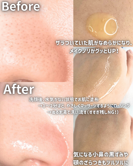 トリプル レチノール ウォッシュピール/Celladix/ピーリングを使ったクチコミ(2枚目)