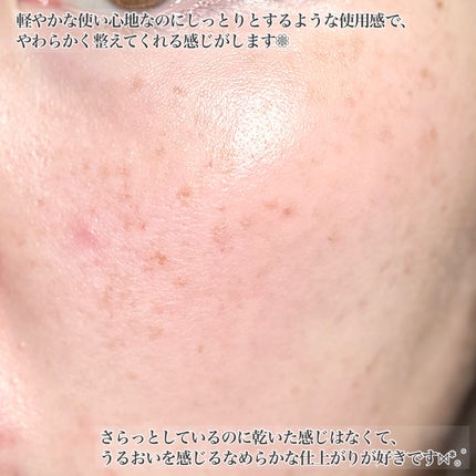 ディープエフェクトスピキュレーションエッセンス/Dr's Touch/化粧水を使ったクチコミ(5枚目)