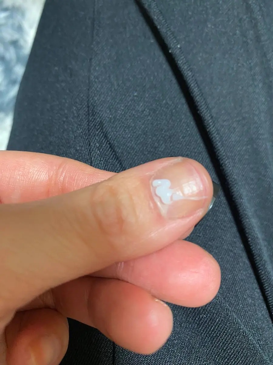 リペア セラム/ネイルホリック/ネイルオイル・トリートメントを使ったクチコミ（2枚目）