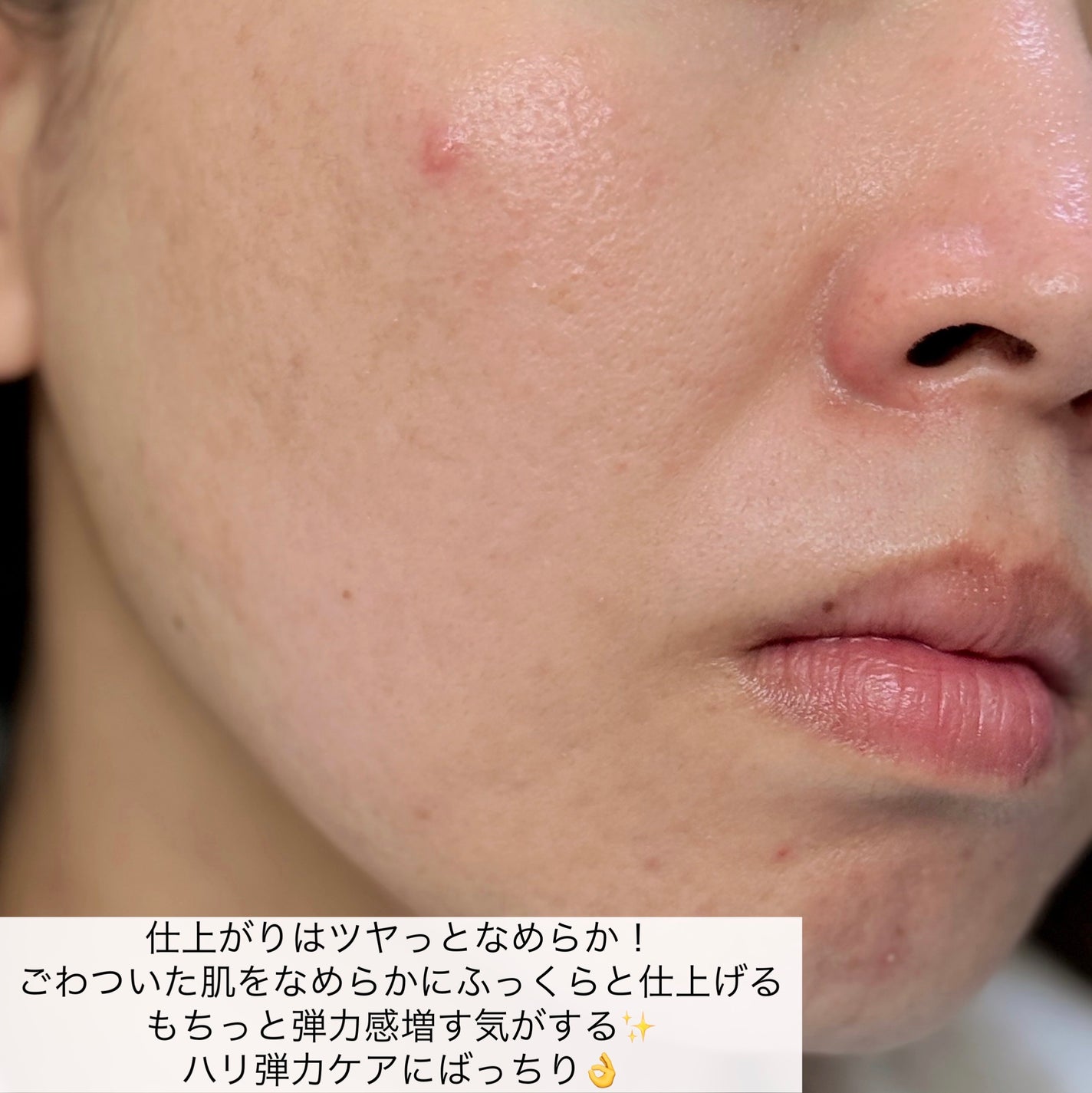 バイオヒールボ プロバイオダーム™ 3Dリフティングクリームマスク/BIOHEAL BOH/シートマスク・パックを使ったクチコミ(7枚目)