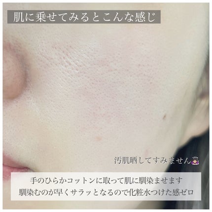 オイデルミン エッセンスローション/SHISEIDO/化粧水を使ったクチコミ(7枚目)