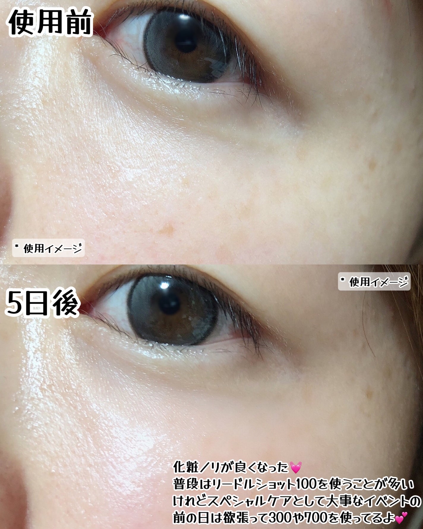 リードルショット100/VT/美容液を使ったクチコミ(4枚目)