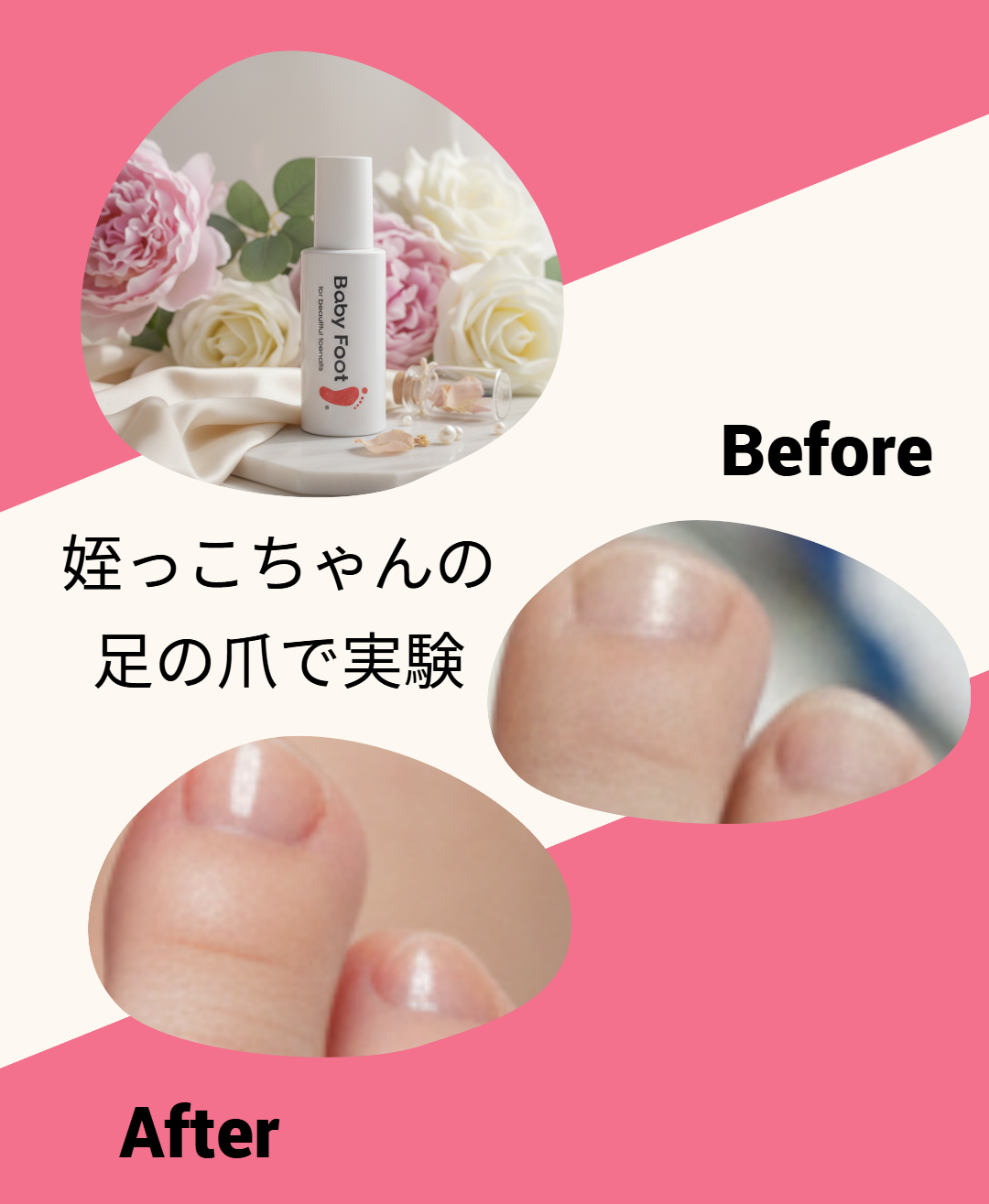 ベビーフット 足爪プロティンパック/ベビーフット/レッグ・フットケアを使ったクチコミ(2枚目)