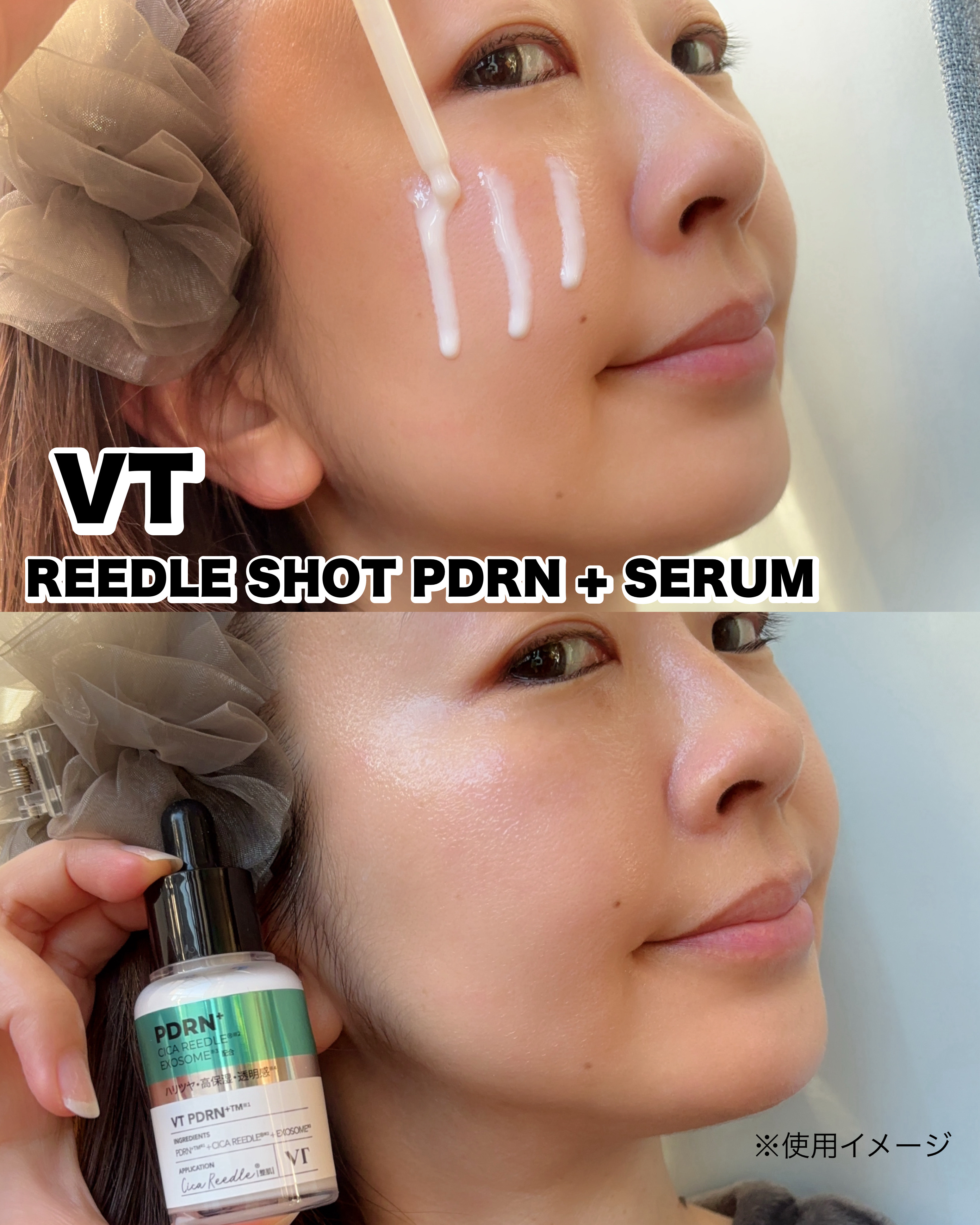 リードルS PDRN+ セラム/VT/美容液を使ったクチコミ（2枚目）