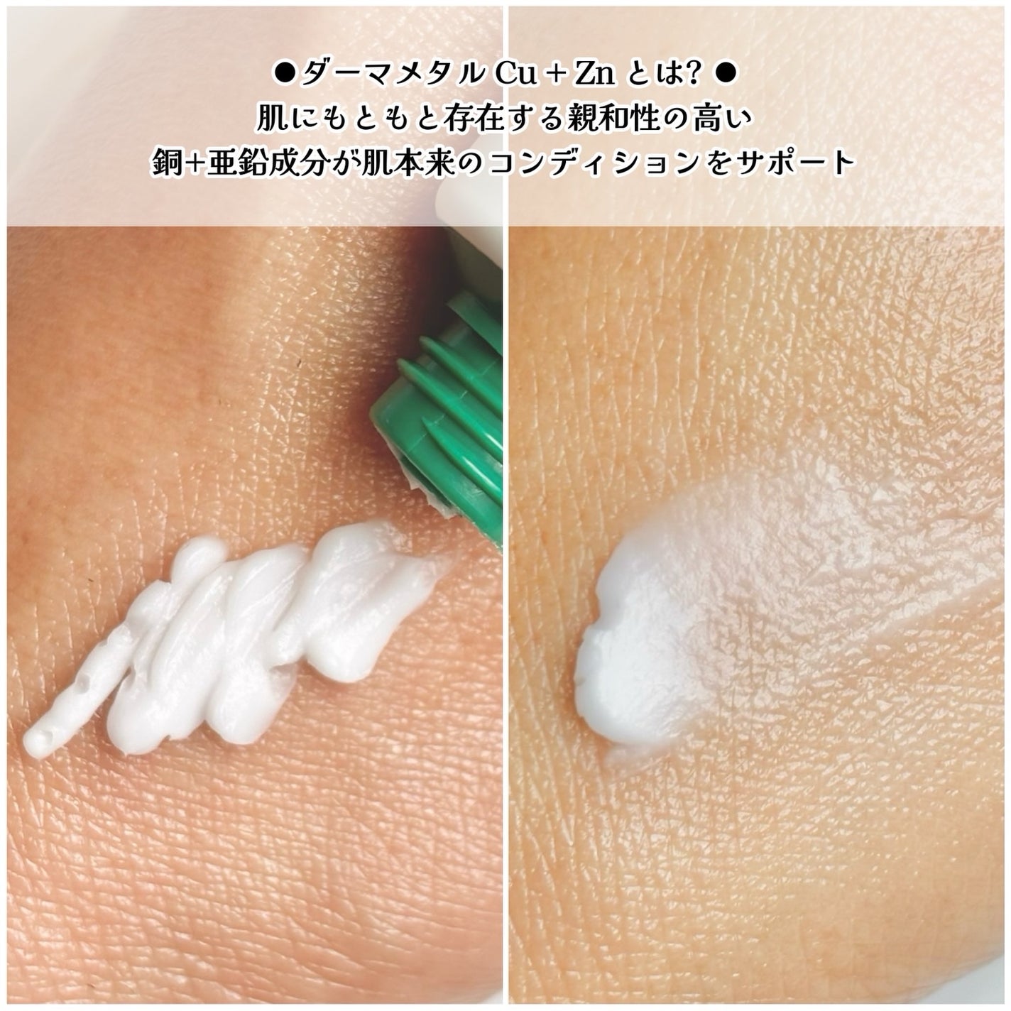 マデカRシカメタルクリーム/Dr.Different/フェイスクリームを使ったクチコミ(6枚目)