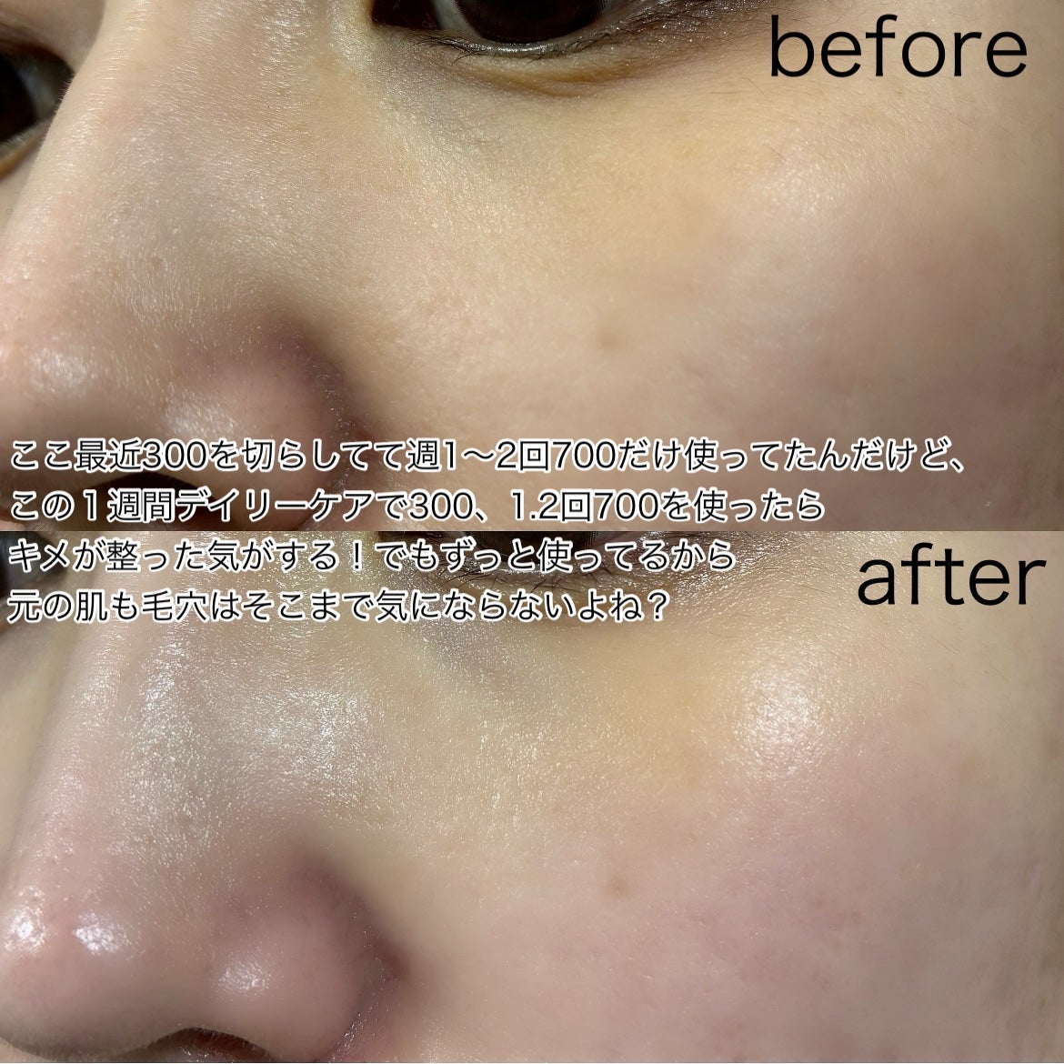 リードルショット100/VT/美容液を使ったクチコミ(5枚目)
