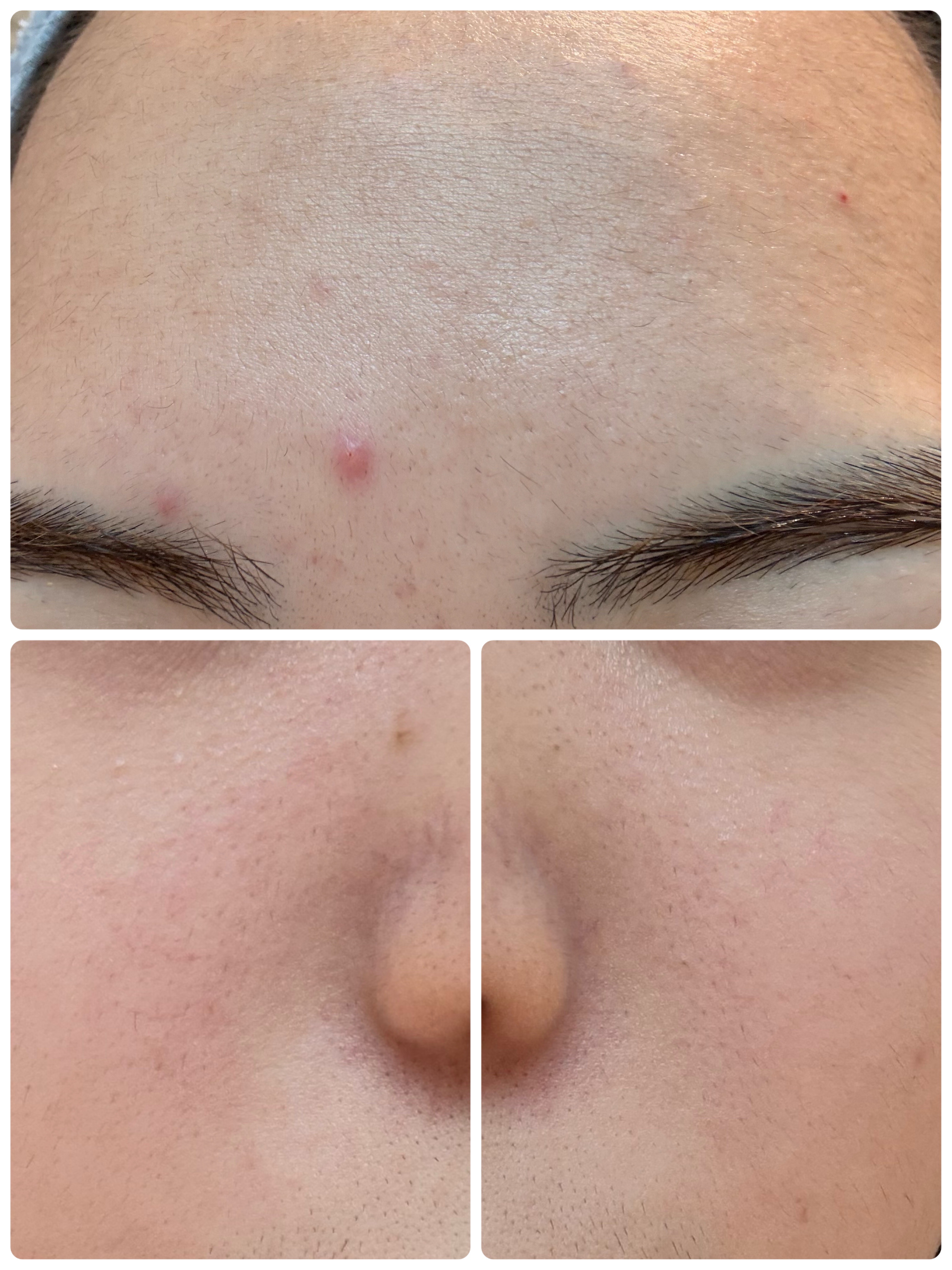 PDRN テンショントナーパッド/VT/トナーパッドを使ったクチコミ（3枚目）