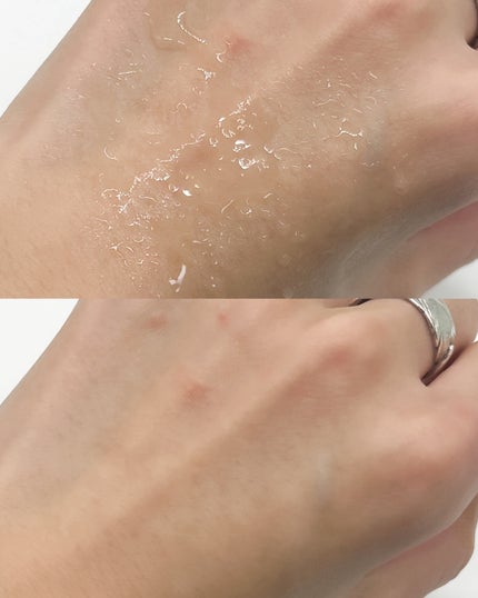 りぴ☆Webライター on LIPS 「アクナルのピンクハーブクレンジングは、メイク・毛穴の詰まり・ざ..」(3枚目)