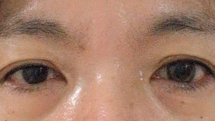 √♡Root lens(ルートレンズ)/Rootlens/ワンデー(1DAY)カラコンを使ったクチコミ(3枚目)