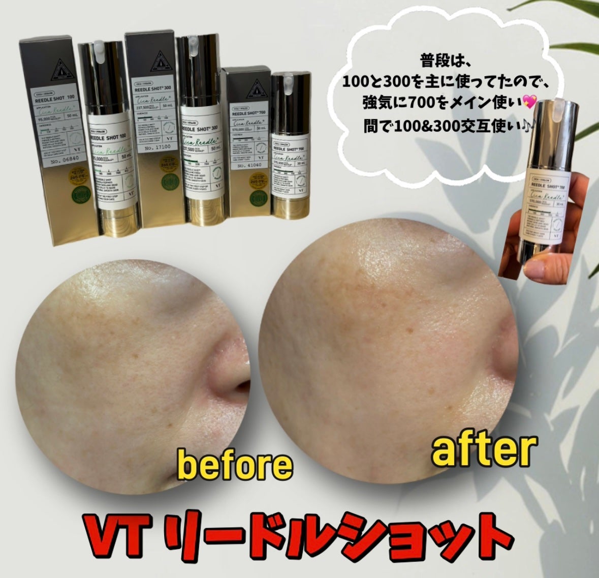 リードルショット100/VT/美容液を使ったクチコミ(3枚目)