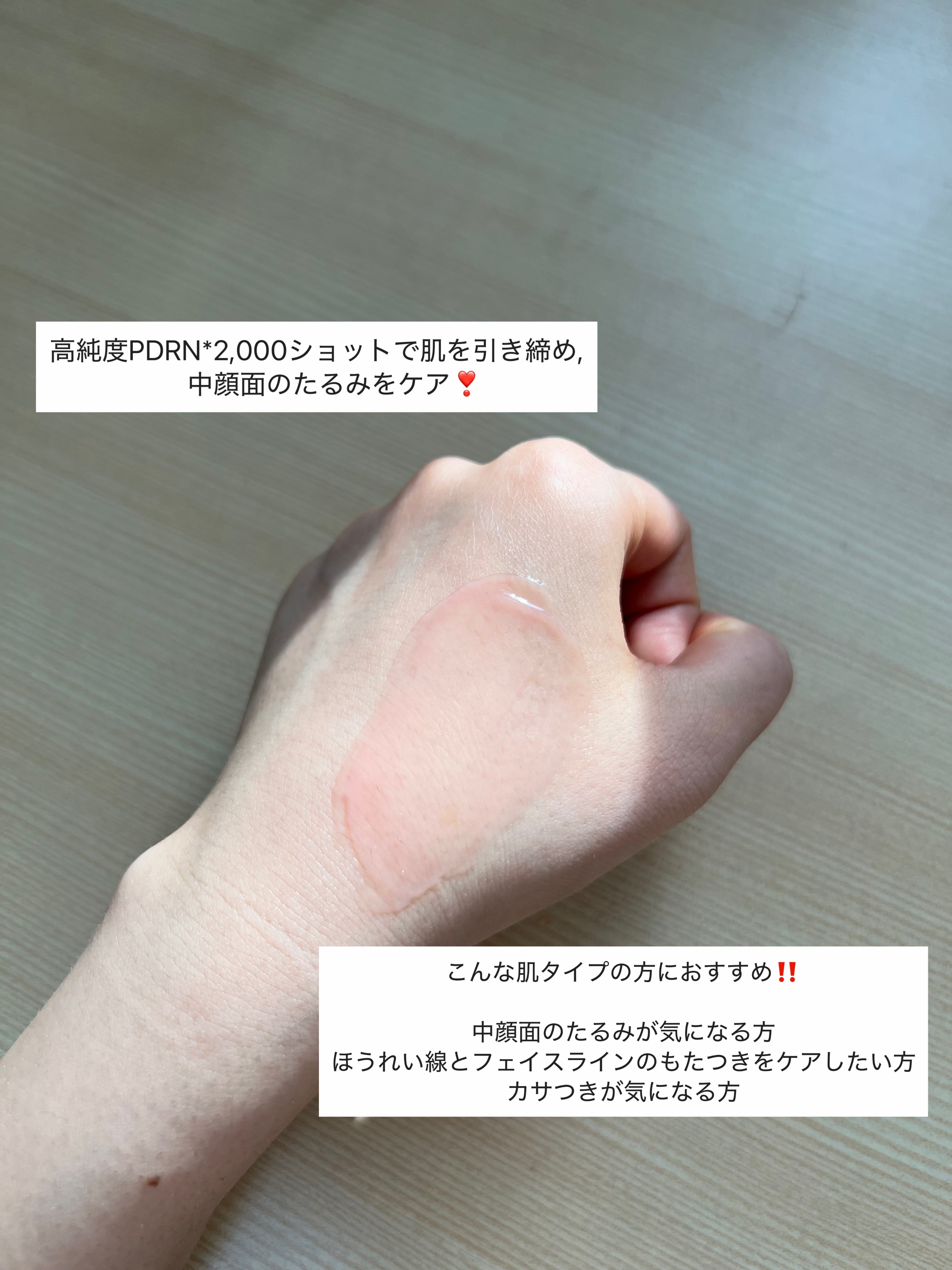 PDRNキューブセラム/DPPR/美容液を使ったクチコミ（3枚目）