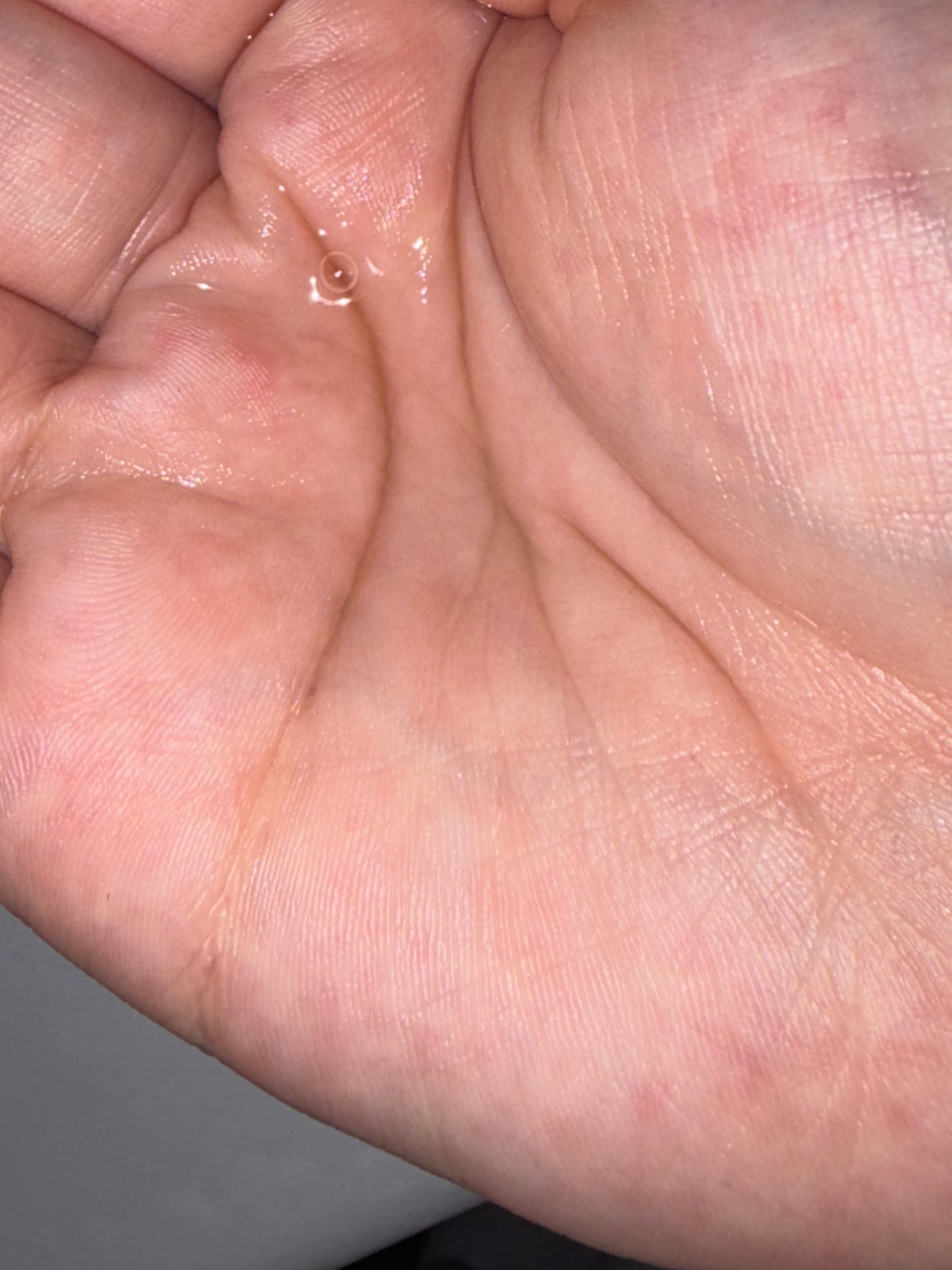 ヘアアクセルレーター レモンライムの香り/加美乃素本舗/頭皮ローションを使ったクチコミ(4枚目)