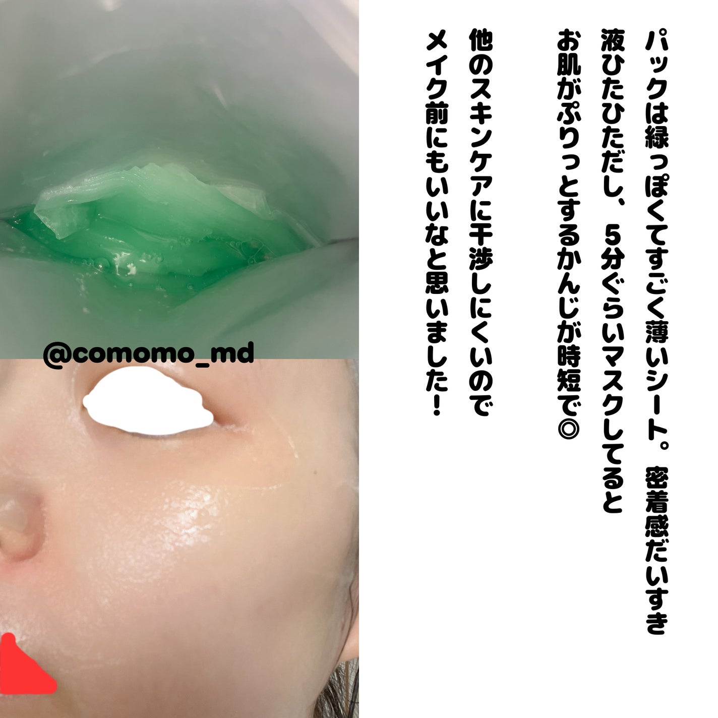 PDRNヒアルロン酸カプセル100セラム/Anua/美容液を使ったクチコミ(3枚目)