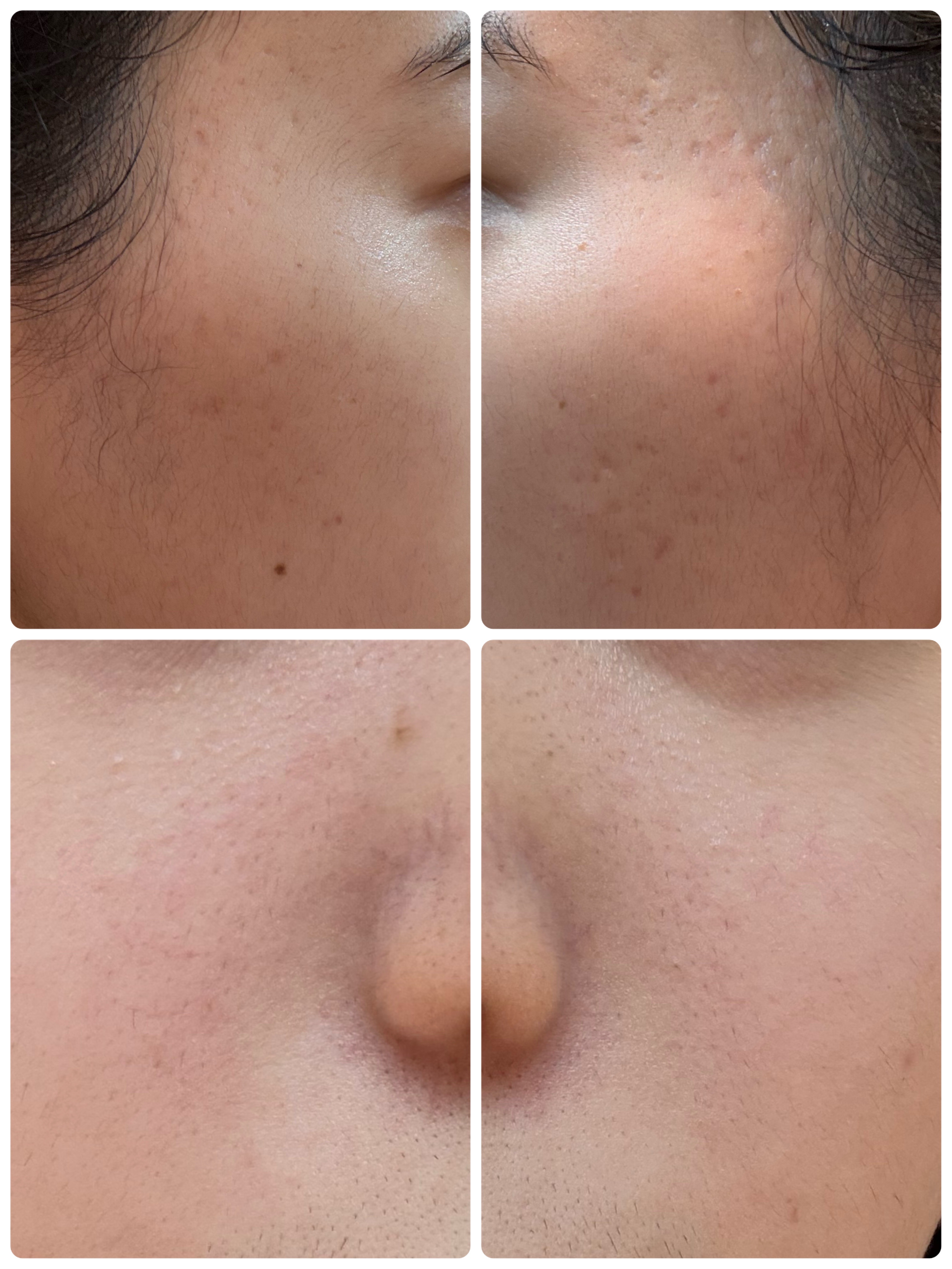 PDRN テンショントナーパッド/VT/トナーパッドを使ったクチコミ（2枚目）