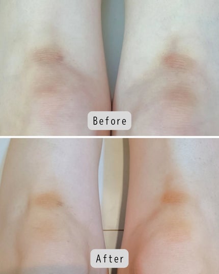 ナイアシンアミド 5% ボディローション/b.clinicx/ボディローションを使ったクチコミ(5枚目)