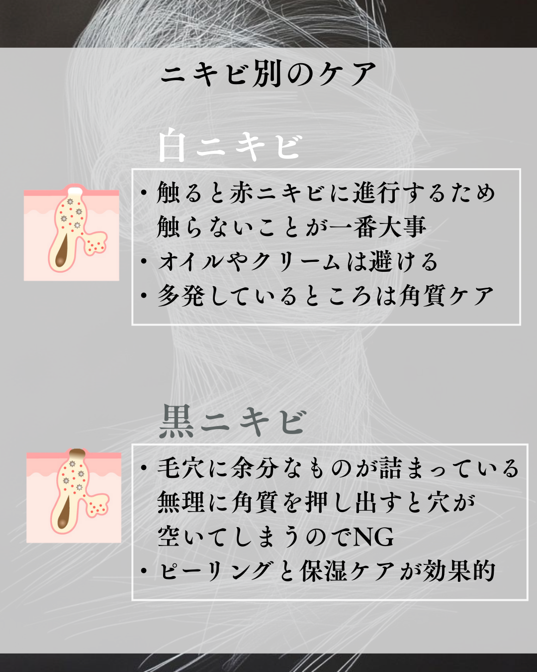 ニキビ治療薬クリーム (医薬品)/クレアラシル/その他を使ったクチコミ(4枚目)