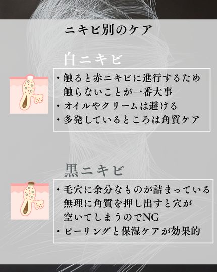 ニキビ治療薬クリーム (医薬品)/クレアラシル/その他を使ったクチコミ(4枚目)