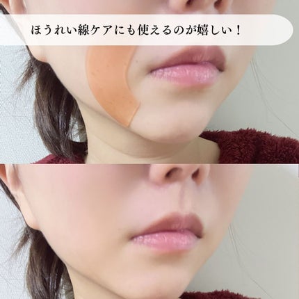 アイソイ 目元集中ケア アイゲルパッチ /ISOI/アイケア・アイクリームを使ったクチコミ(3枚目)