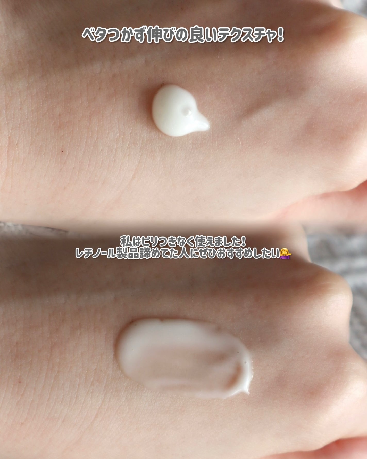 アルティモイストレチノVAセラム/エトヴォス/美容液を使ったクチコミ(3枚目)