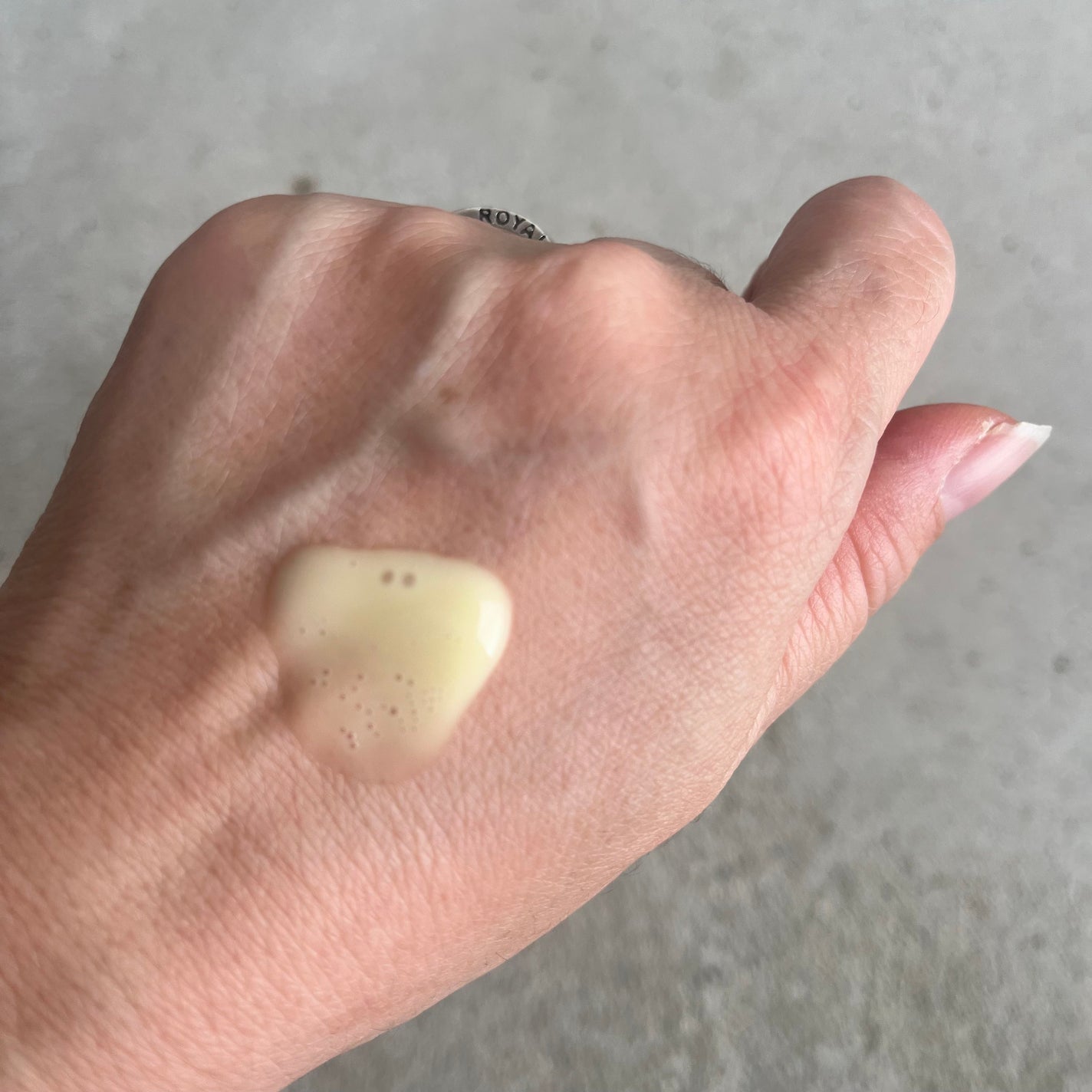 バイオティクスバイタルネックパッチ/VARI:HOPE/ネック・デコルテケアを使ったクチコミ(4枚目)