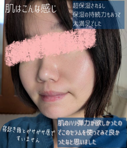 ペプタテノール10 バリアセラム/ANOTHER FACE/美容液を使ったクチコミ(4枚目)