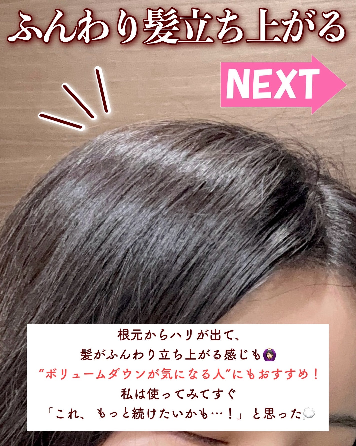 グローターンヘアアンプル/リリーイブ/頭皮ローションを使ったクチコミ(6枚目)