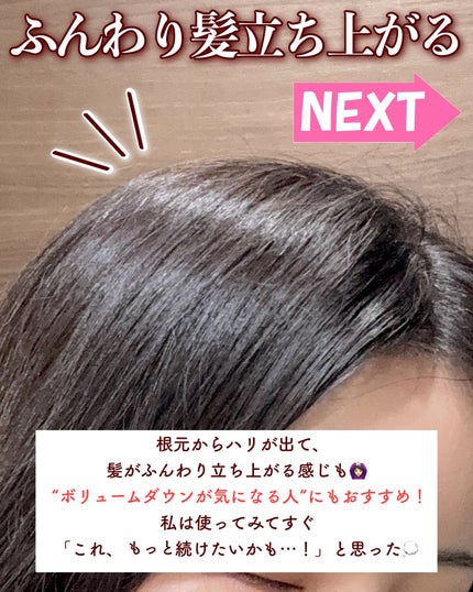 グローターンヘアアンプル/リリーイブ/頭皮ローションを使ったクチコミ(6枚目)