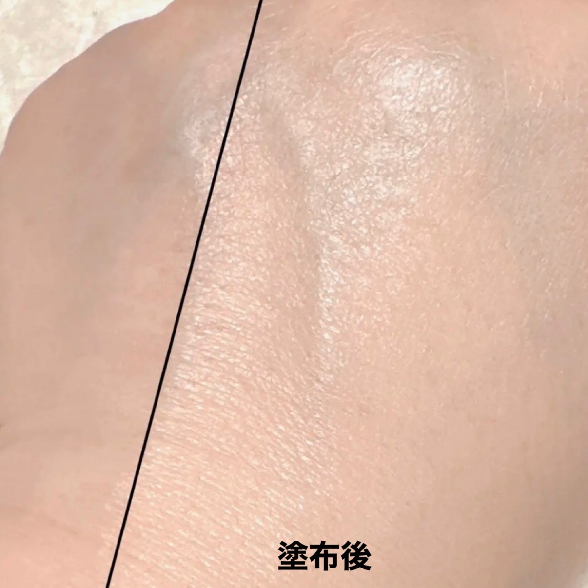 ダーマシンコンシーラー/23years old/リキッドコンシーラーを使ったクチコミ(6枚目)