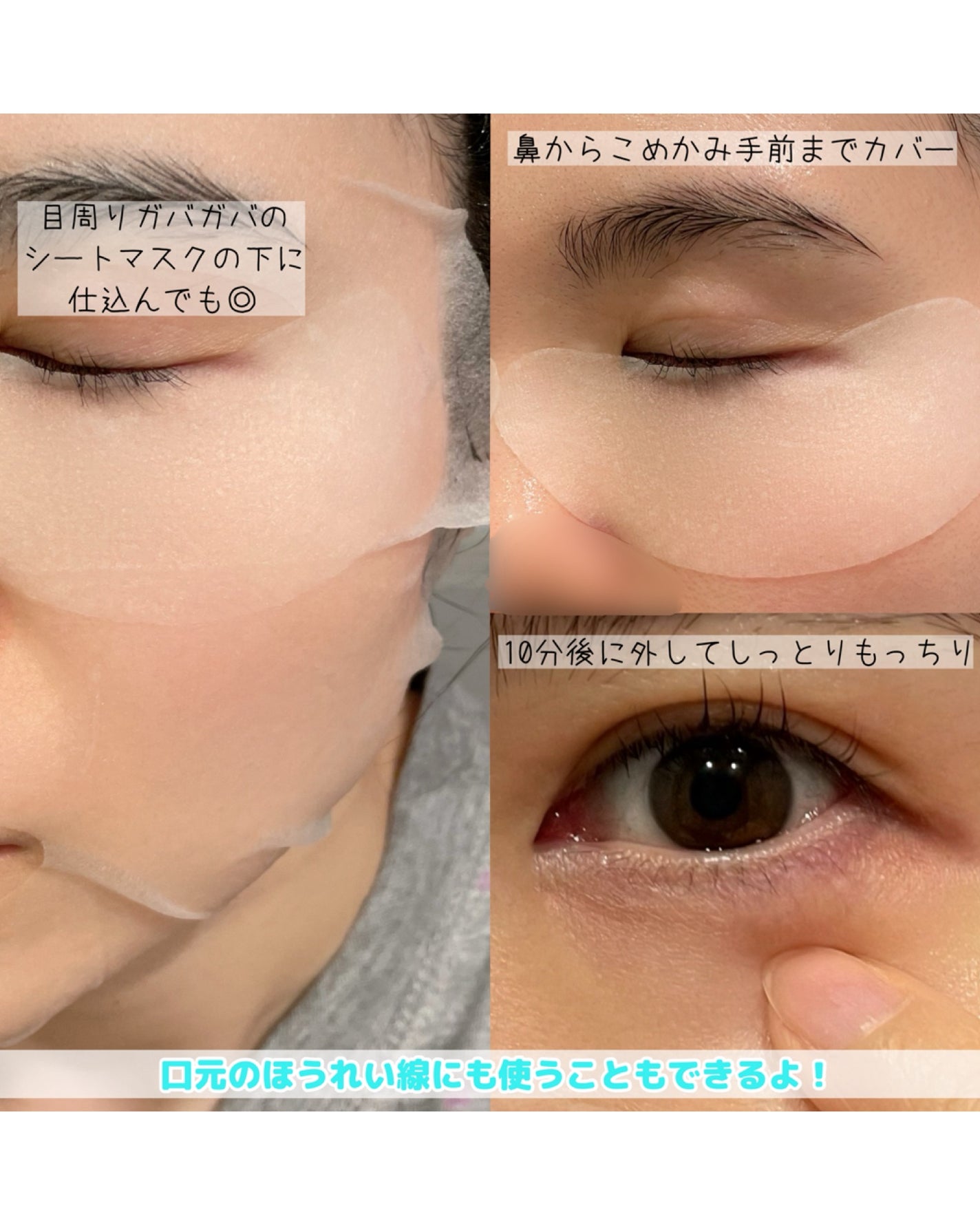 メディシナルモイスチャーアイシート/eLα/シートマスク・パックを使ったクチコミ(4枚目)