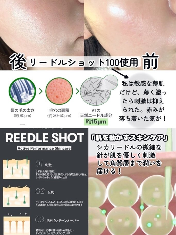 リードルショット700/VT/美容液を使ったクチコミ（3枚目）