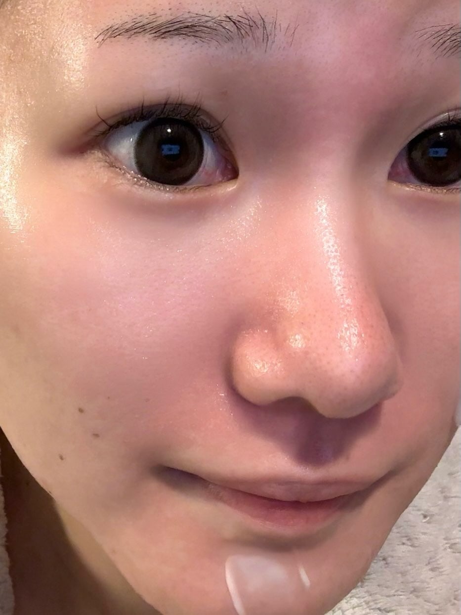 レッドブレミッシュ リペアスージングクリーム/Dr.G/フェイスクリームを使ったクチコミ(4枚目)