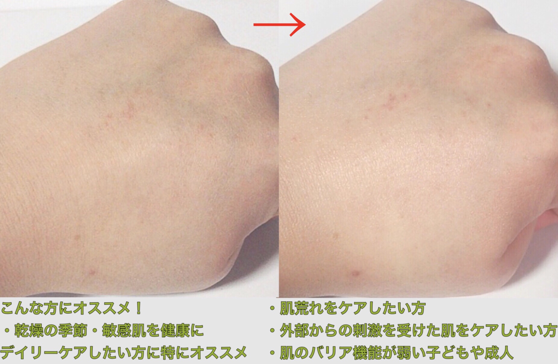 インテンシブクリーム/ZEROID/フェイスクリームを使ったクチコミ（3枚目）