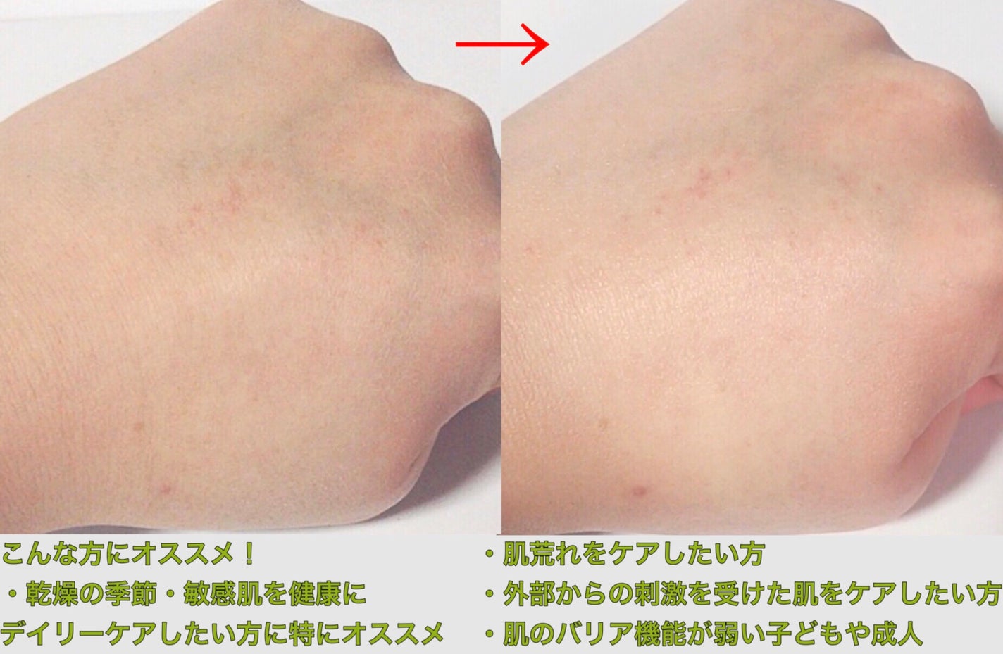 インテンシブクリーム/ZEROID/フェイスクリームを使ったクチコミ(3枚目)