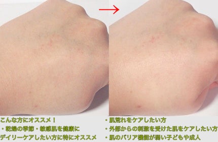 インテンシブクリーム/ZEROID/フェイスクリームを使ったクチコミ(3枚目)