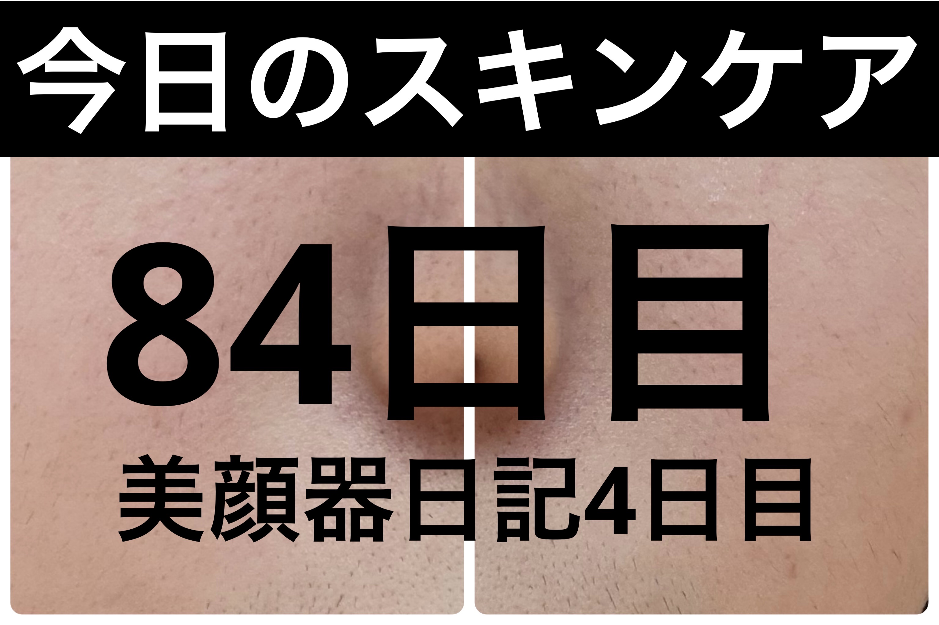 PDRN テンショントナーパッド/VT/トナーパッドを使ったクチコミ（1枚目）