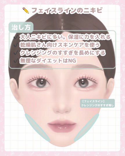 ロゼット洗顔パスタ アクネクリア/ロゼット/洗顔フォームを使ったクチコミ(10枚目)