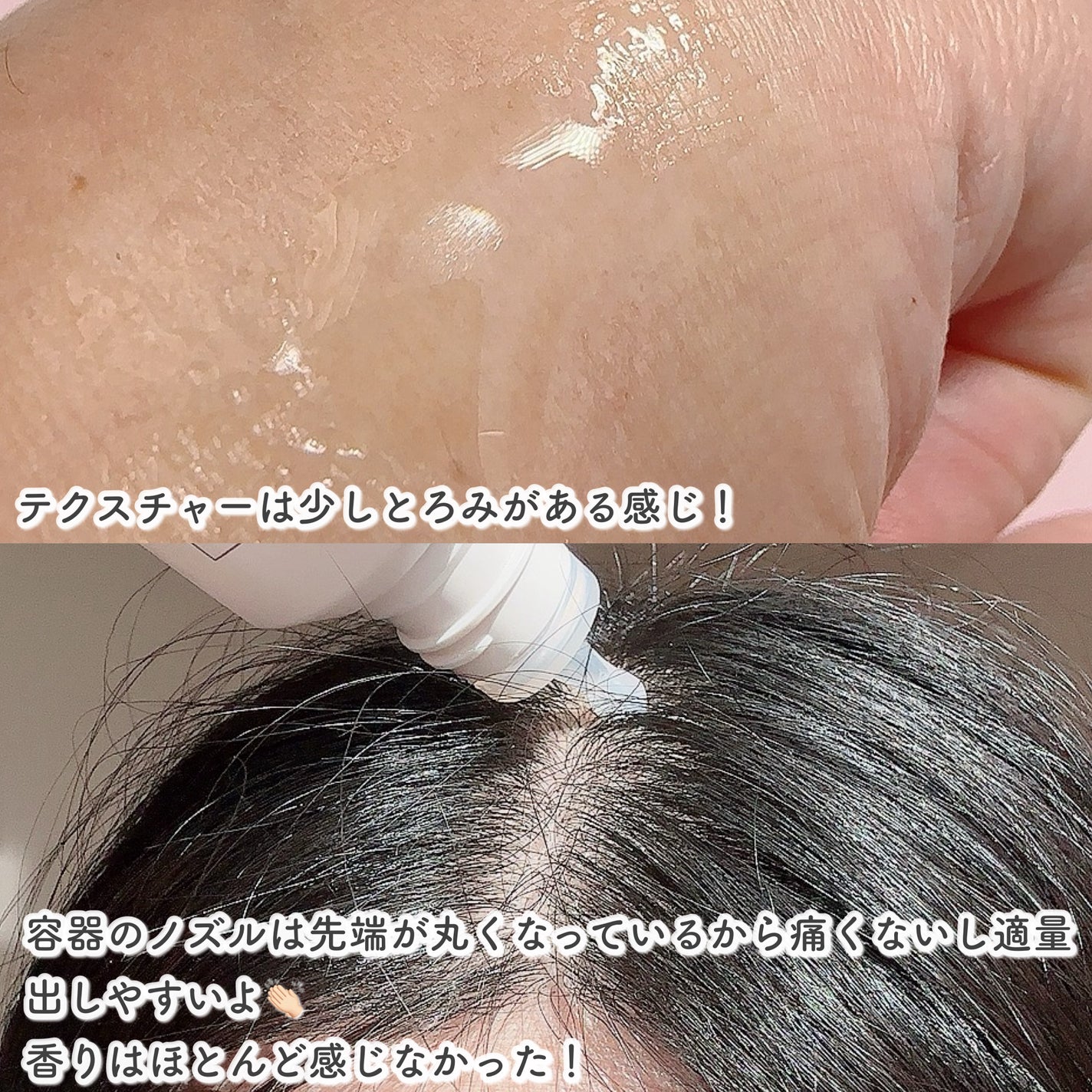 スカルプD ボーテ 薬用頭皮保湿美容液/アンファー(スカルプD)/頭皮ローションを使ったクチコミ(3枚目)