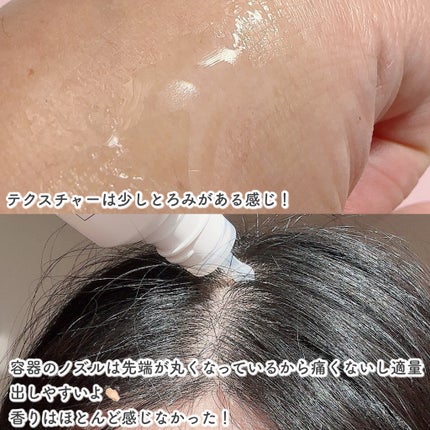 スカルプD ボーテ 薬用頭皮保湿美容液/アンファー(スカルプD)/頭皮ローションを使ったクチコミ(3枚目)