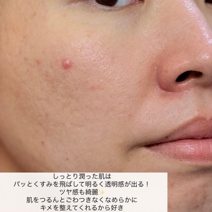 コラーゲン エッセンシャルマスクコアファーミング 1枚/MEDIHEAL/シートマスク・パックの画像