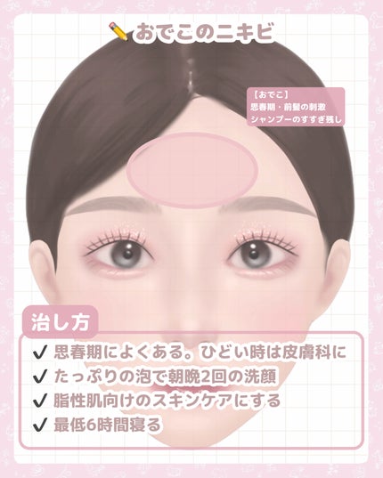 ロゼット洗顔パスタ アクネクリア/ロゼット/洗顔フォームを使ったクチコミ(4枚目)