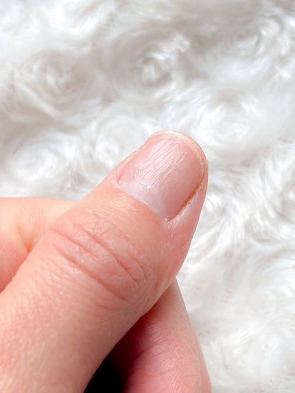 リペア セラム/ネイルホリック/ネイルオイル・トリートメントを使ったクチコミ(4枚目)