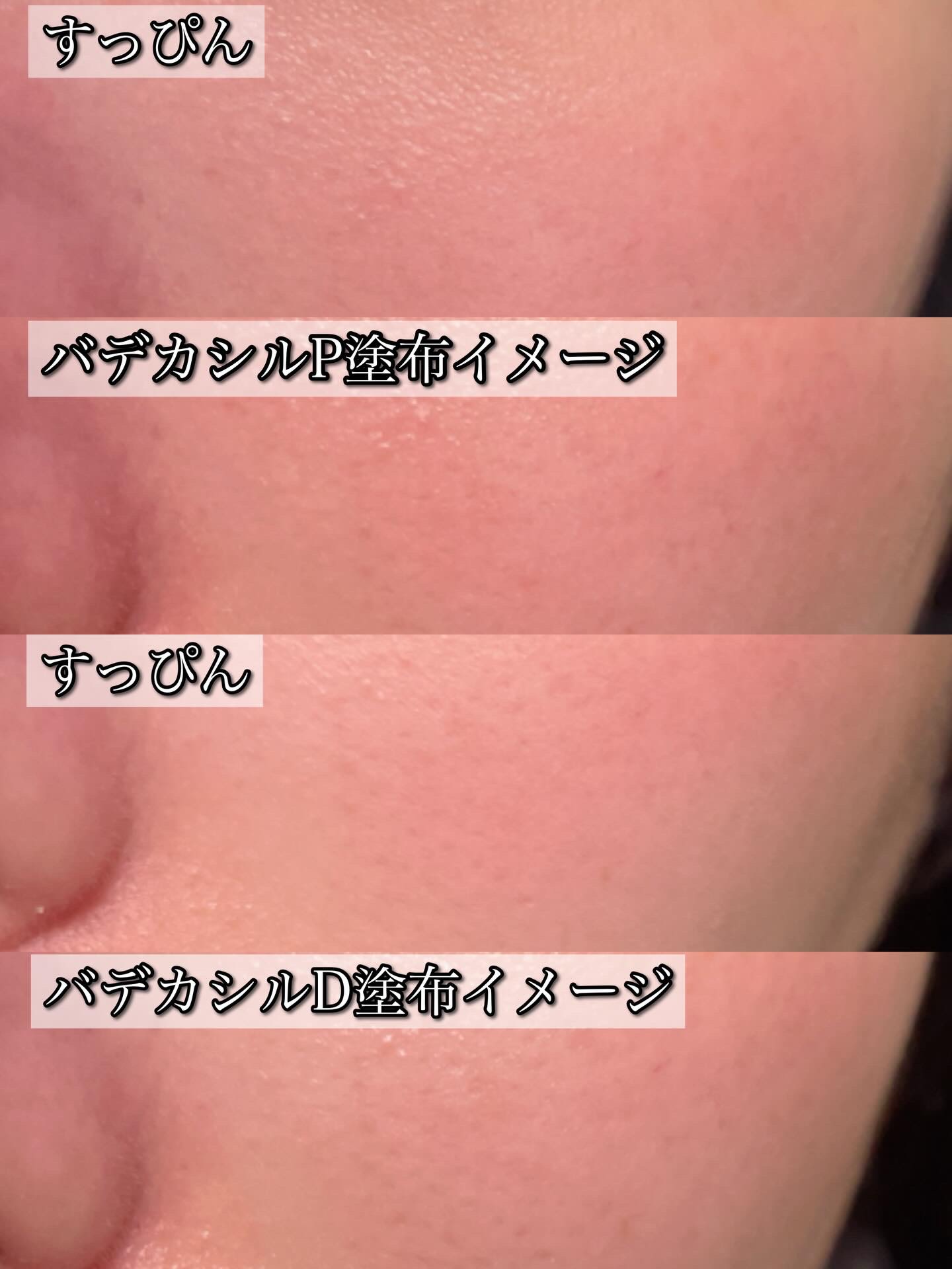 バデカシルDクリーム/23years old/フェイスクリームを使ったクチコミ（3枚目）