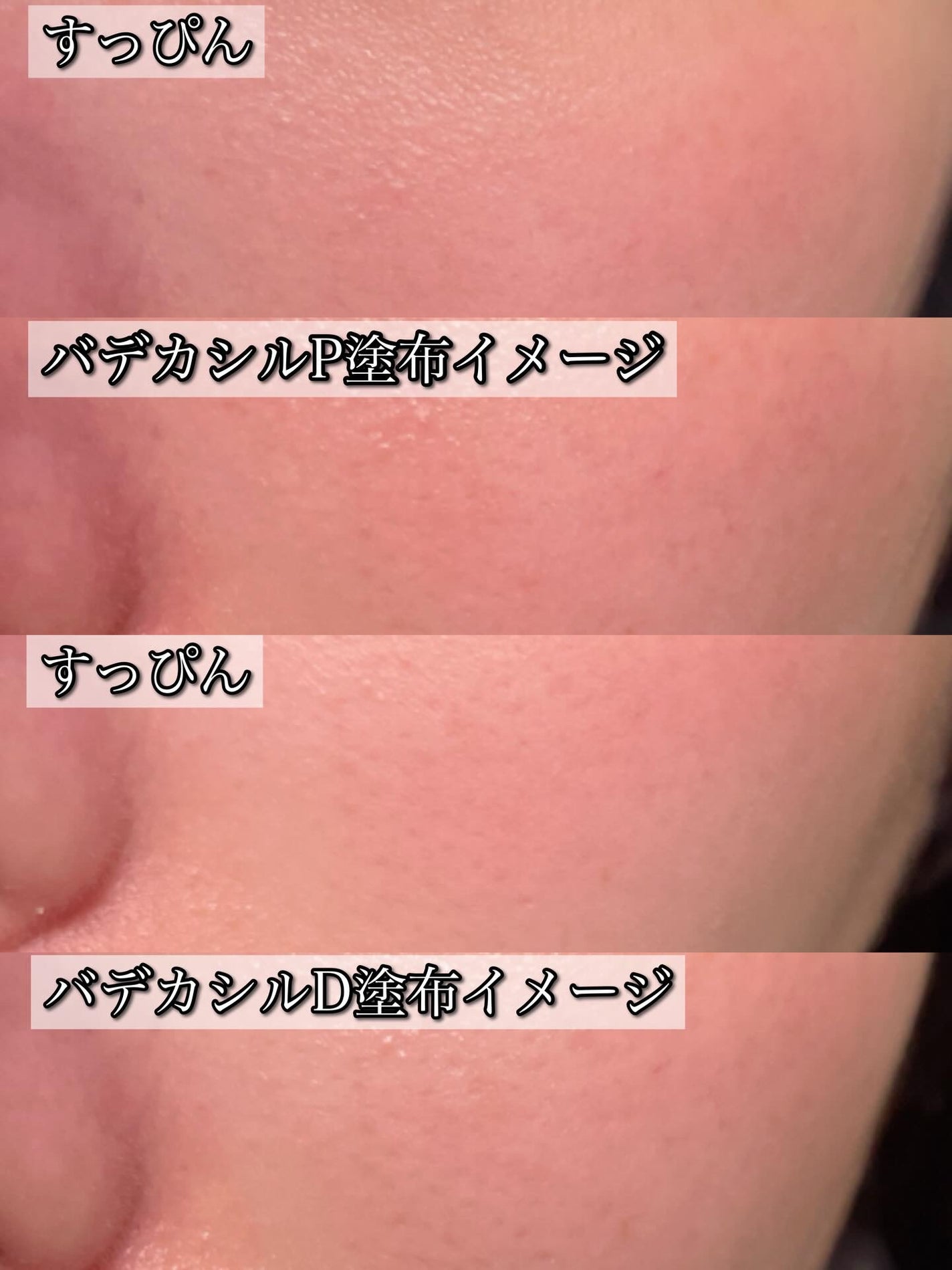 バデカシルDクリーム/23years old/フェイスクリームを使ったクチコミ(3枚目)