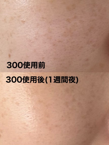 リードルショット100/VT/美容液を使ったクチコミ(4枚目)