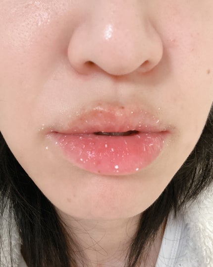 リップエイド集中マスク/トレンドホリック/リップマスクを使ったクチコミ(4枚目)