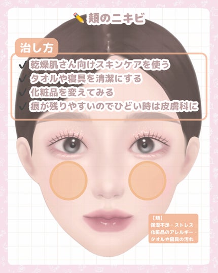 ロゼット洗顔パスタ アクネクリア/ロゼット/洗顔フォームを使ったクチコミ(7枚目)