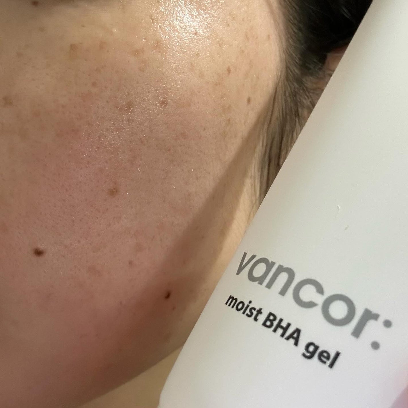 モイストバハゲル(BHA gel)/vancor(バンコル)/ピーリングを使ったクチコミ(8枚目)