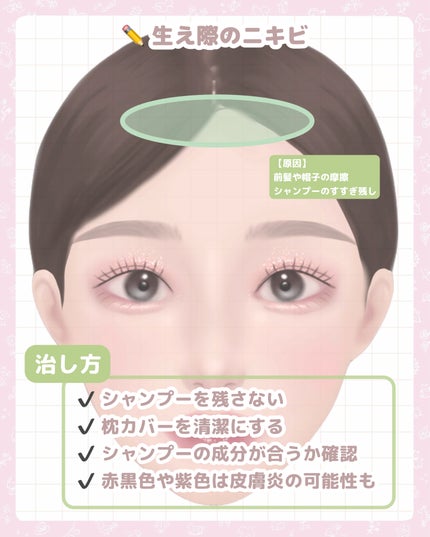 薬用クリア化粧水/メンソレータム アクネス/化粧水を使ったクチコミ(3枚目)