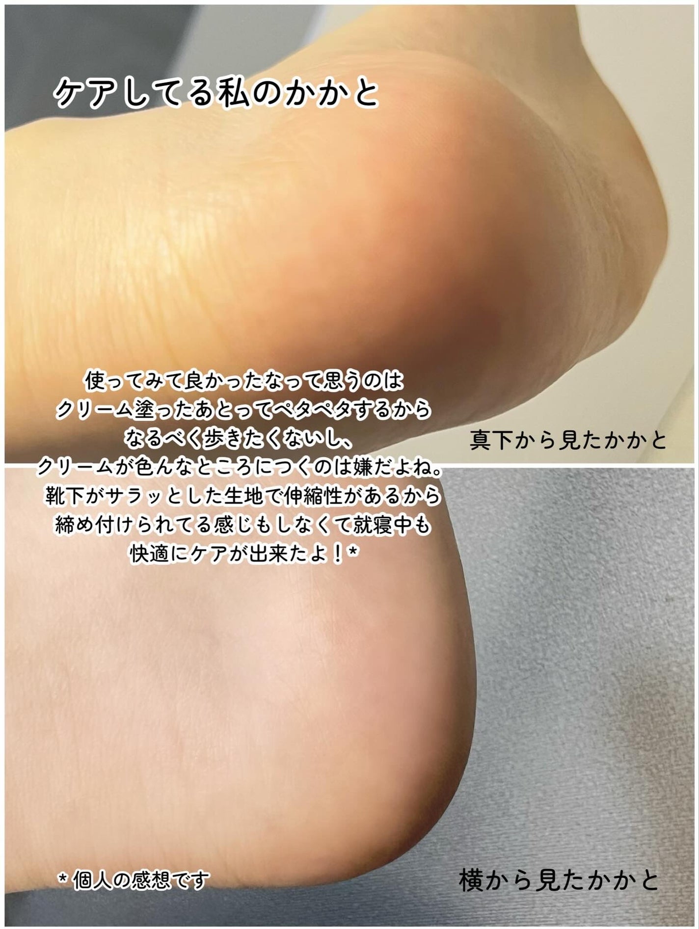 ベビーフット かかと用/ベビーフット/レッグ・フットケアを使ったクチコミ(4枚目)